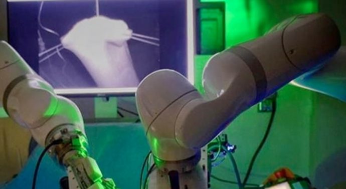Robot successfully performs world’s Laparoscopic surgery without human help
